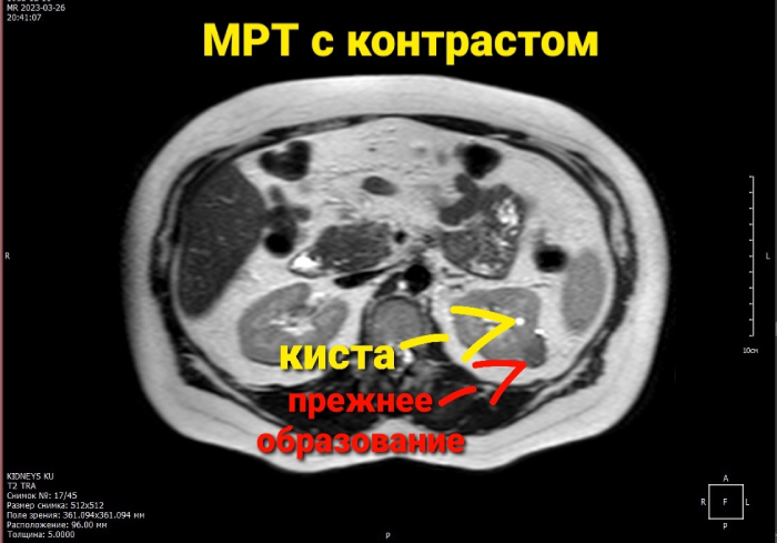 МРТ с контрастом